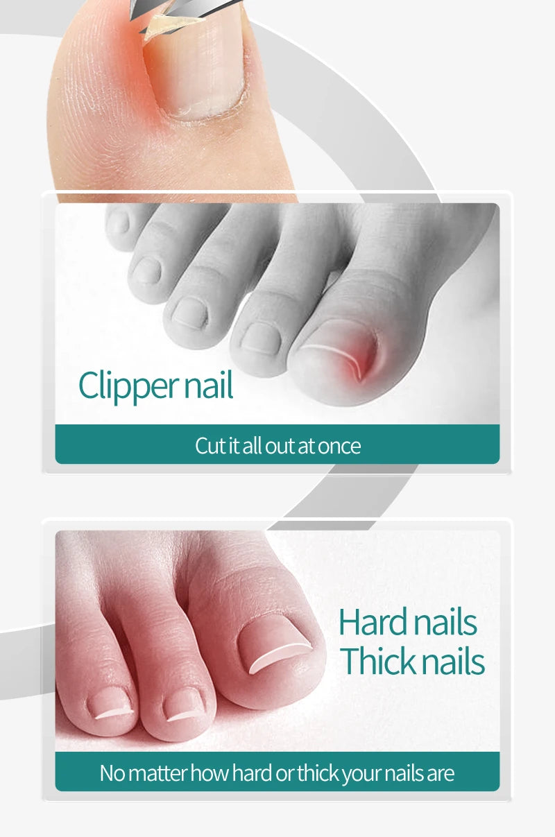 Toenail Clipper For Ingrown Or Thick Toenails Toenails Trimmer Professional Podiatrist Toenail Nipper With Stainless Steel Ultra