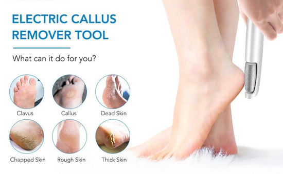 Electric Feet Callus Remover USB Rechargeable Electric Foot Grinder For Removing Dead Skin Feet Calluses Pedicure Care Tools