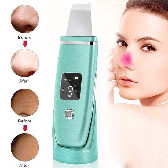 Ultrasonic Blackhead Remover Deep Cleansing Face Scrubber Pore Cleaner Peeling Shovel