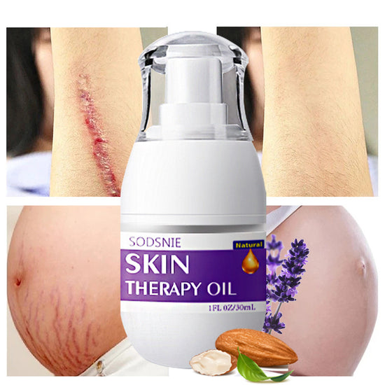 Skin Treatment Oil Remove Puncture Cellulite Stretch Mark
